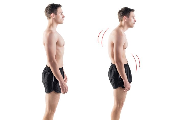 posture-epaule