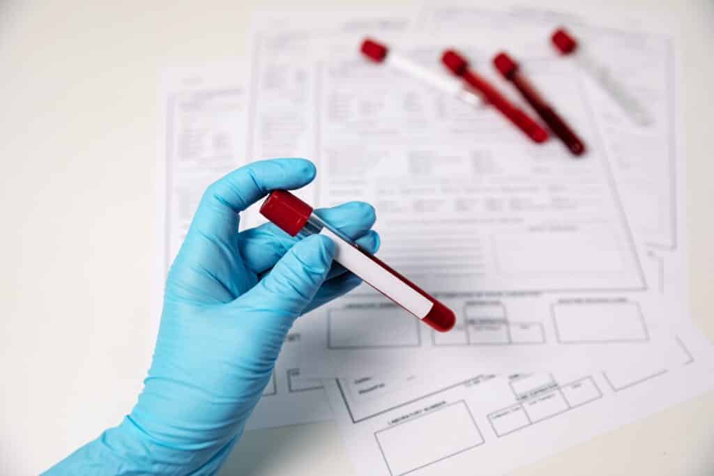 analyse sanguine
