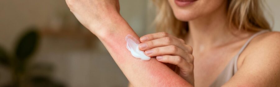 Femme européenne appliquant une crème hydratante sur son avant-bras présentant des plaques rouges d’eczéma